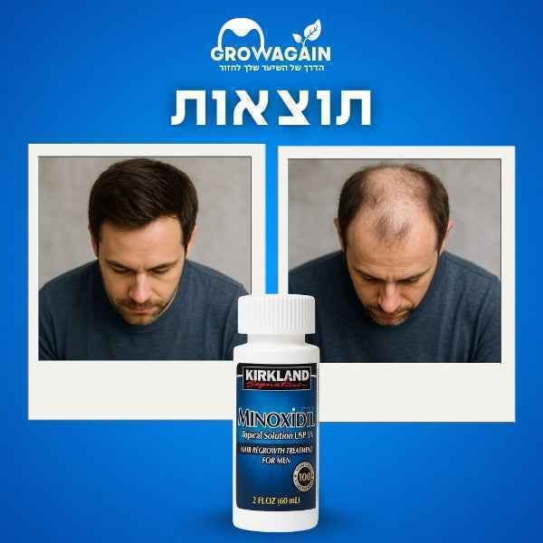 מינוקסידיל 5% מארז שנתי